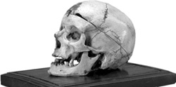 Il cranio del brigante Giuseppe Villella custodito al Museo 